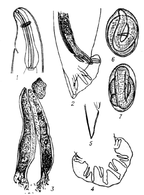 Рис. 2. Dictyocaulus arnfieldi.