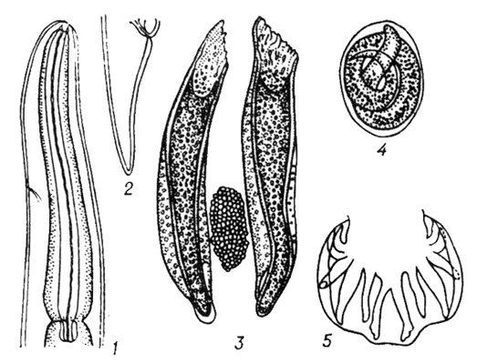 Рис. 3. Dictyocaulus viviparus.