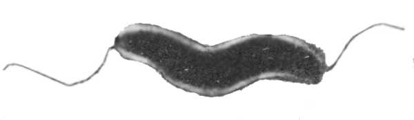 Рис. 2. Возбудитель кампилобактериоза крупного рогатого скота при электронной микроскопии.