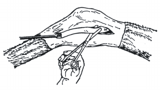 Отсечение ножницами сухожилия сгибателя большого пальца и заднего большеберцового мускула лошади.