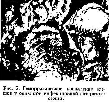 Болит внизу живота нету месячных