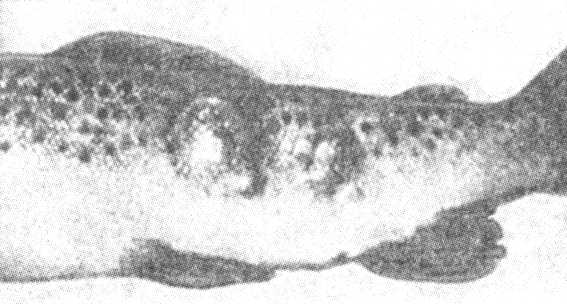 Рис. 1. Фурункулы в мышцах у кумжи при подостром течении аэромоноза лососёвых.