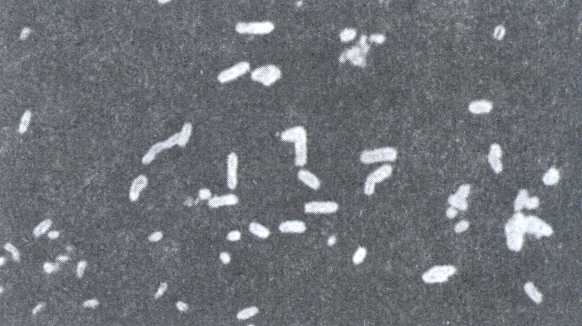 Рис. 6. Мазок из суточной культуры листерий, окрашенный по непрямому методу люминесцирующих антител.