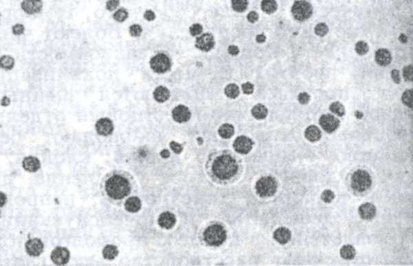 Рис. 2. Колонии Mycoplasma gallisepticum на полутвёрдом агаре.