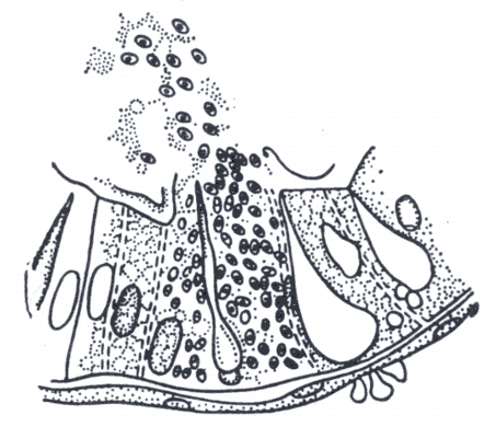 Рис. 1. Разрушение клеток эпителия средней кишки шелкопряда (видны споры ноземы, отторгаемые в просвет кишечника).