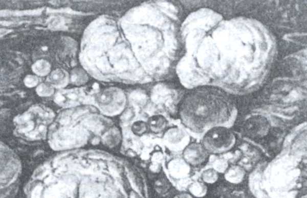 Рис. 2. Поражённые фолликулы яичников при пуллорозе—тифе.