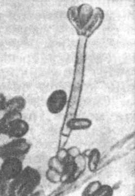 Рис. 2. Конидиеносец с розеткой стеригм гриба Stachybotrys alternans (по Саркисову).