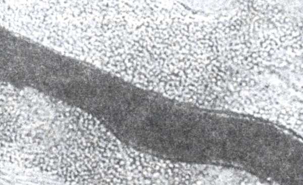 Рис. 1. Чехол из спор Trichophytosis verrucosum вокруг волоса.