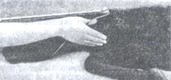 Рис. 1. Продвижение пилы на место разреза при ампутации головы и шеи (пилу захватывают между большим пальцем и ладонью).