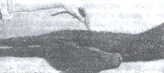 Рис. 2. Обводка пилы петлепроводом вокруг завёрнутой шеи и головы.