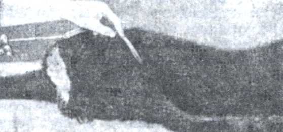 Рис. 3. Обводка пилы между грудной клеткой и согнутой в левом плечевом суставе конечностью.