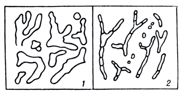 Рис. 2. Схематическое изображение гиф мукоровых грибов в тканях (1) и гиф аспергиллов в тканях (2) (по Dvorak и др.).