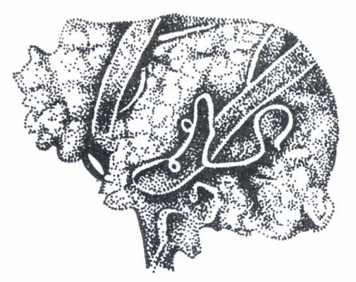 Рис. 2. Элафостронгилы в головном мозге северного оленя (по Полянской).